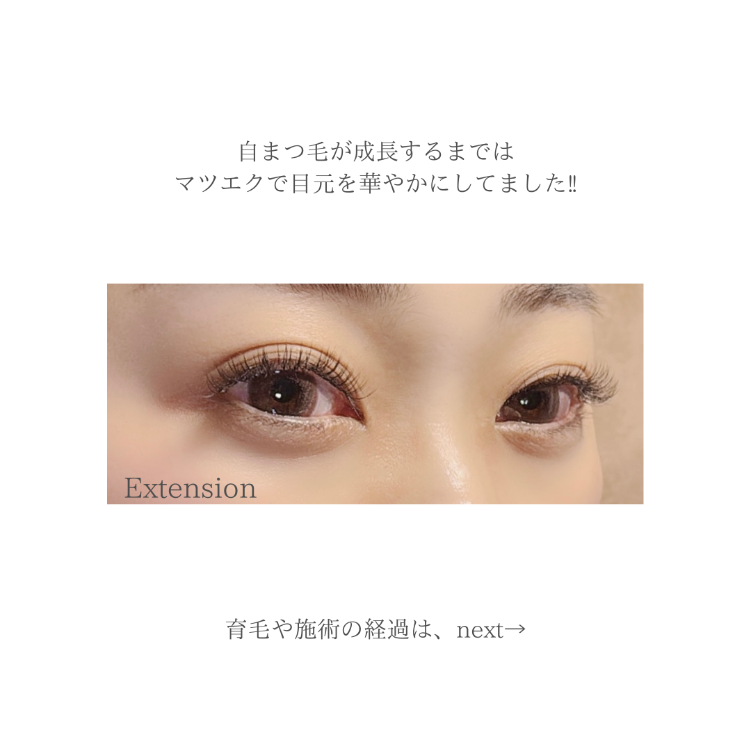 【 育てるまつ毛美容液・ラッシュアディクト 】